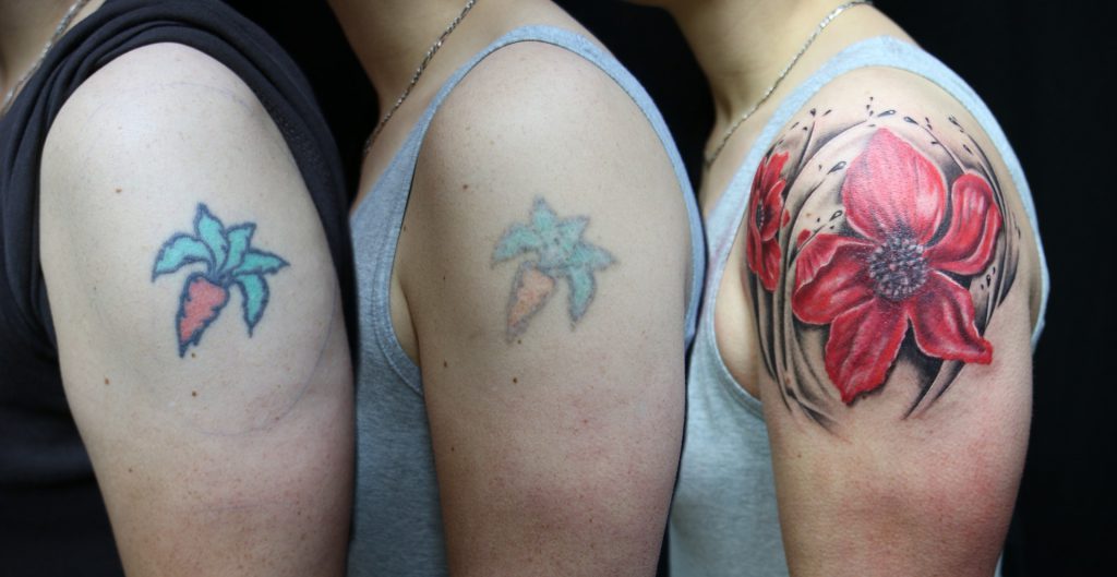 cosmetic surgery loans
